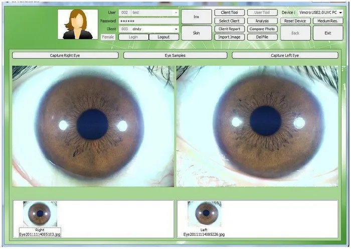 EH-660U iris scanner analyzer USB Eye Iriscope Iridology camera 5.0 MP 4 LED/2 LED Iris Analyser Iridoscope+Pro Soft