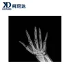 develope sex,scanner ct,sex medical equipment