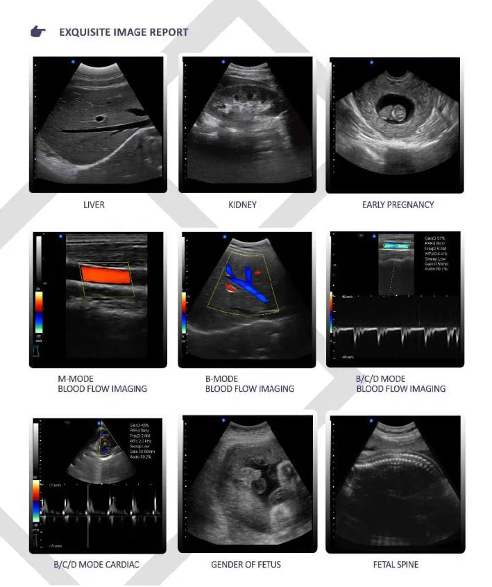 New Color Doppler Ultrasound Machine Ecografo Price Color Doplar
