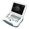 High Quality Expert Digital portable Ultrasound Scan Machine Price