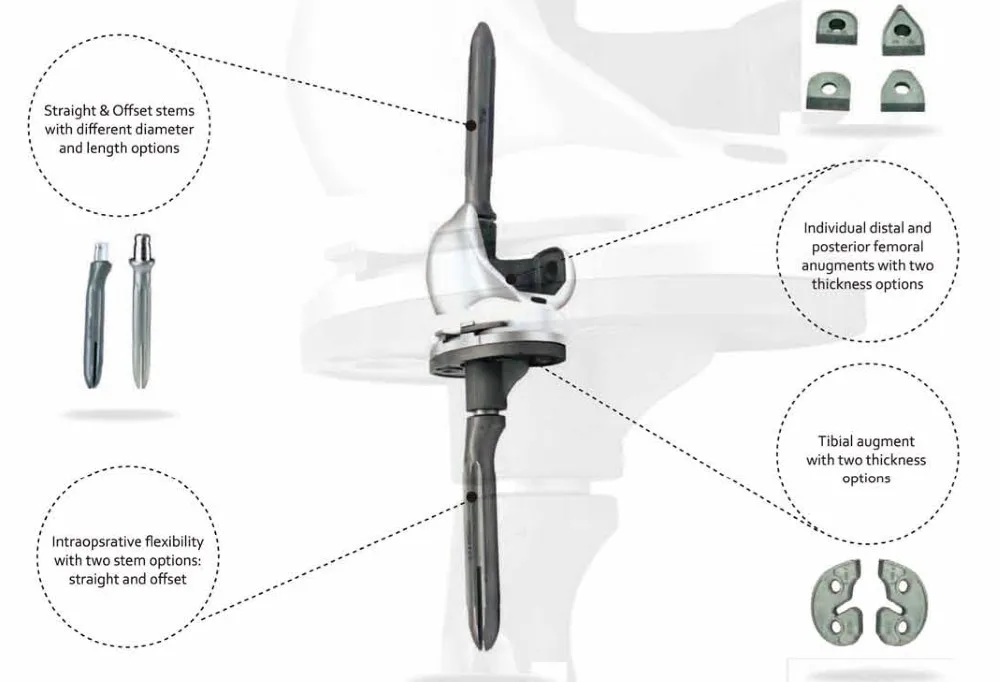 Knee Revision Replacement Implant System Buy Revision Knee
