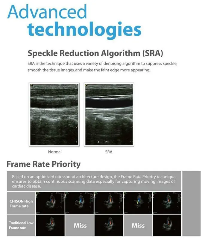 Cardiac Vascular doppler