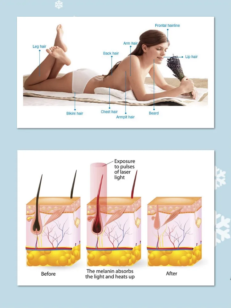 Laser hair removal spa/ candela laser alexandrite soprano ice platinum 808 diode laser hair removal machine