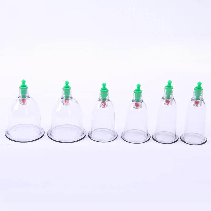 Chinese Medical Therapy Vacuum Cupping Set Buy Cupping Set,Cuppingset