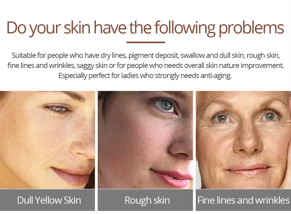 crocodile oil for stretch marks