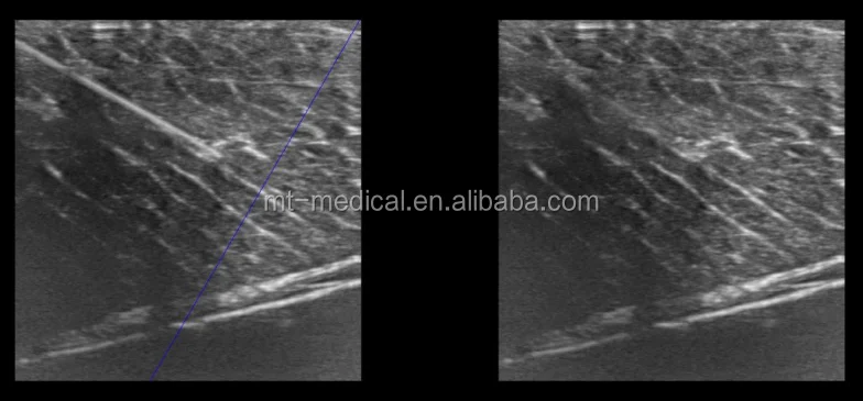 Medical Ultrasound More Than Two Probe Socket Portable Scanner