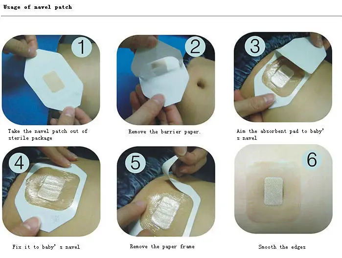 Medical Transparent Adhesive Island Dressing Buy Medical Dressing