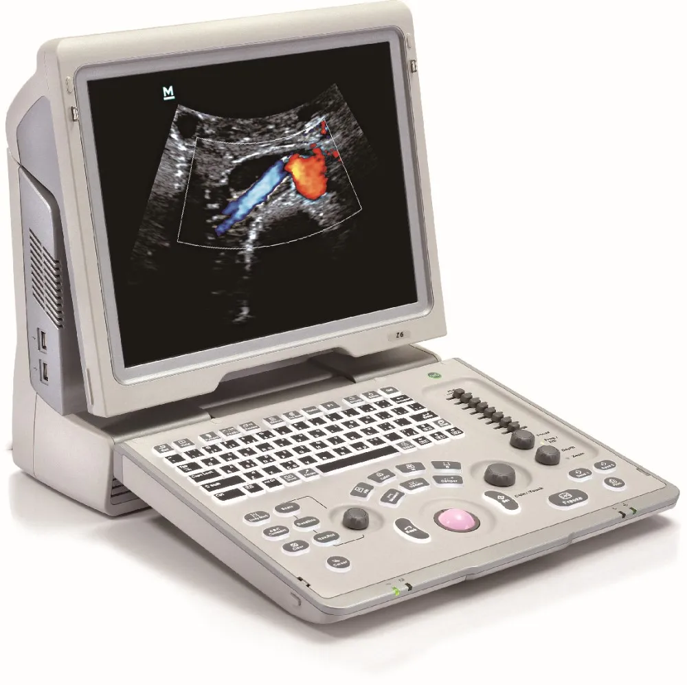 doppler ultrasound pregnancy machine