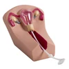 General Doctor Female Intrauterine Contraceptive Device Training Model