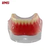 dental implant system dental training model