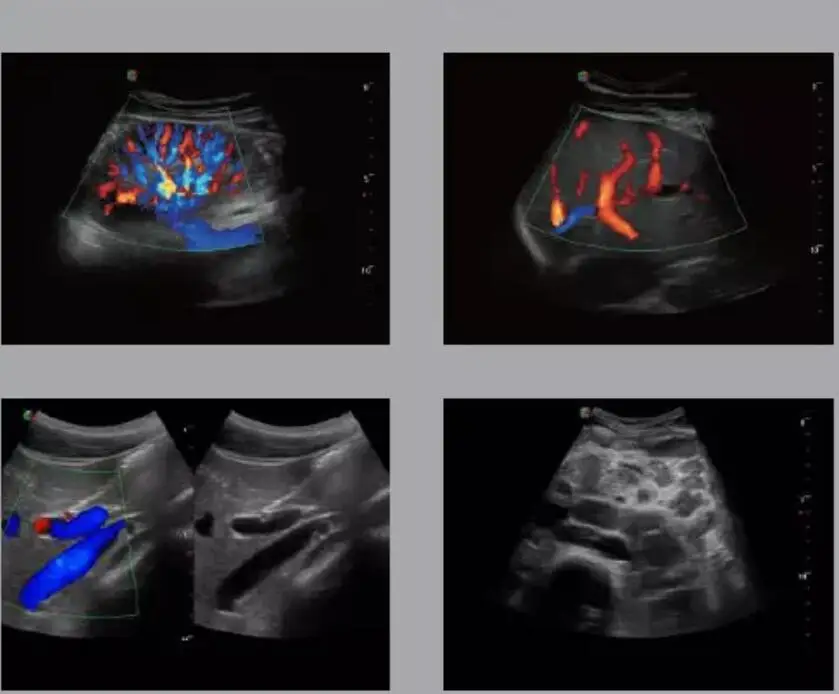 Sonoscape S9 Medis Echography Portabel Usg Mesin 3d 4d Buy Mindray Usg Mesin 4d Ultrasound Mesin Usg Sonoscape Product On Alibaba Com