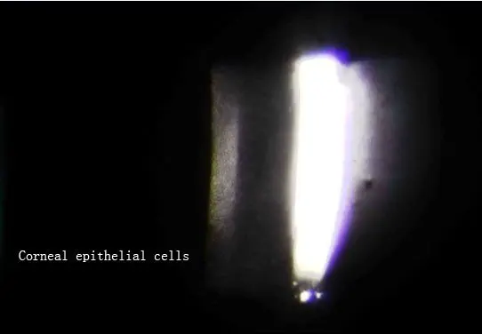 corneal epithelial cells.jpg
