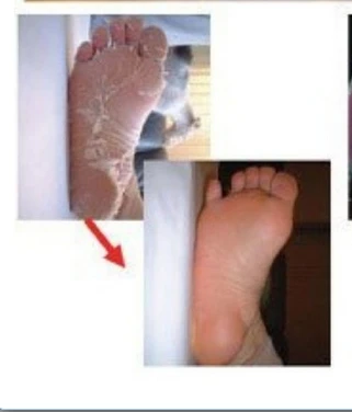 China manufacturer OEM baby feet formula foot feeling mask