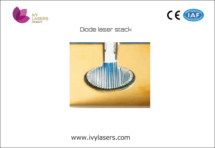 Detail of G-stack 750