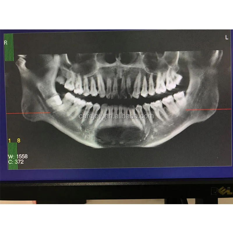 CBCT (7).jpg