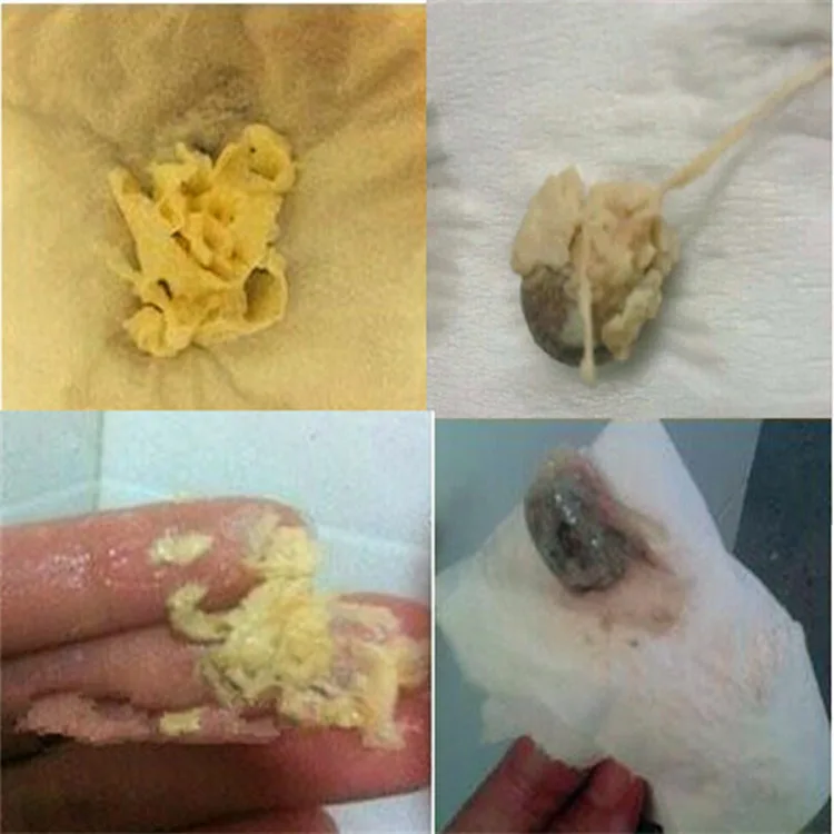 草药阴道栓剂阴道清洁 yoni 珍珠私人部件清洁