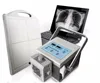 medical x-ray digitizer medical x-ray machine portable radiology equipment