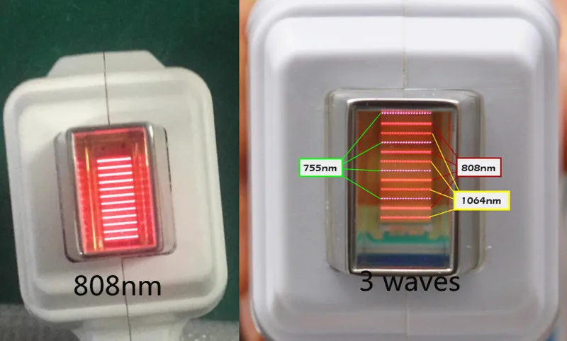 808nm Diode Laser Machine  808nm Portable Laser Hair Removal Price