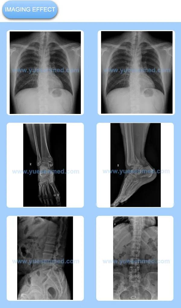 02 Imaging Effect Digital X-ray System YSDR-UC32 YSDR-UC50 YSDR-C32 YSDR-C50