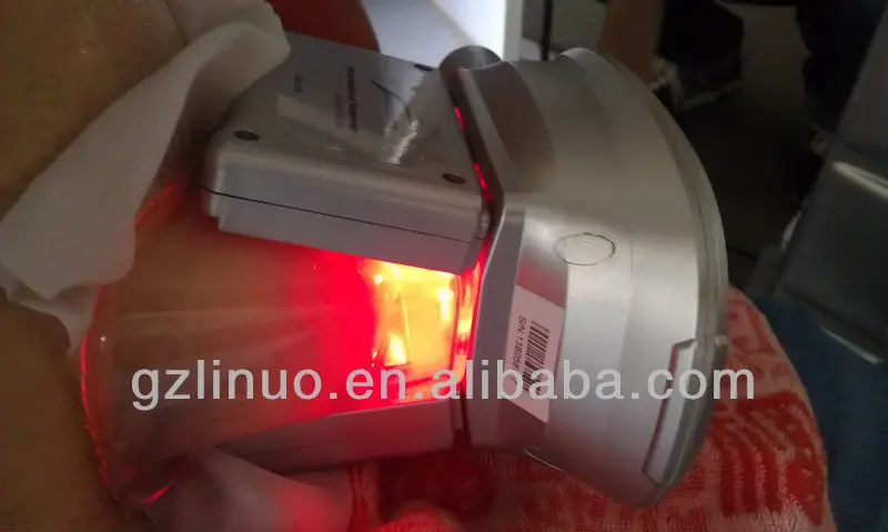 Linuo body criolipolisis freeze fat fast slimming machine cryolipolysis apparatus for weight loss