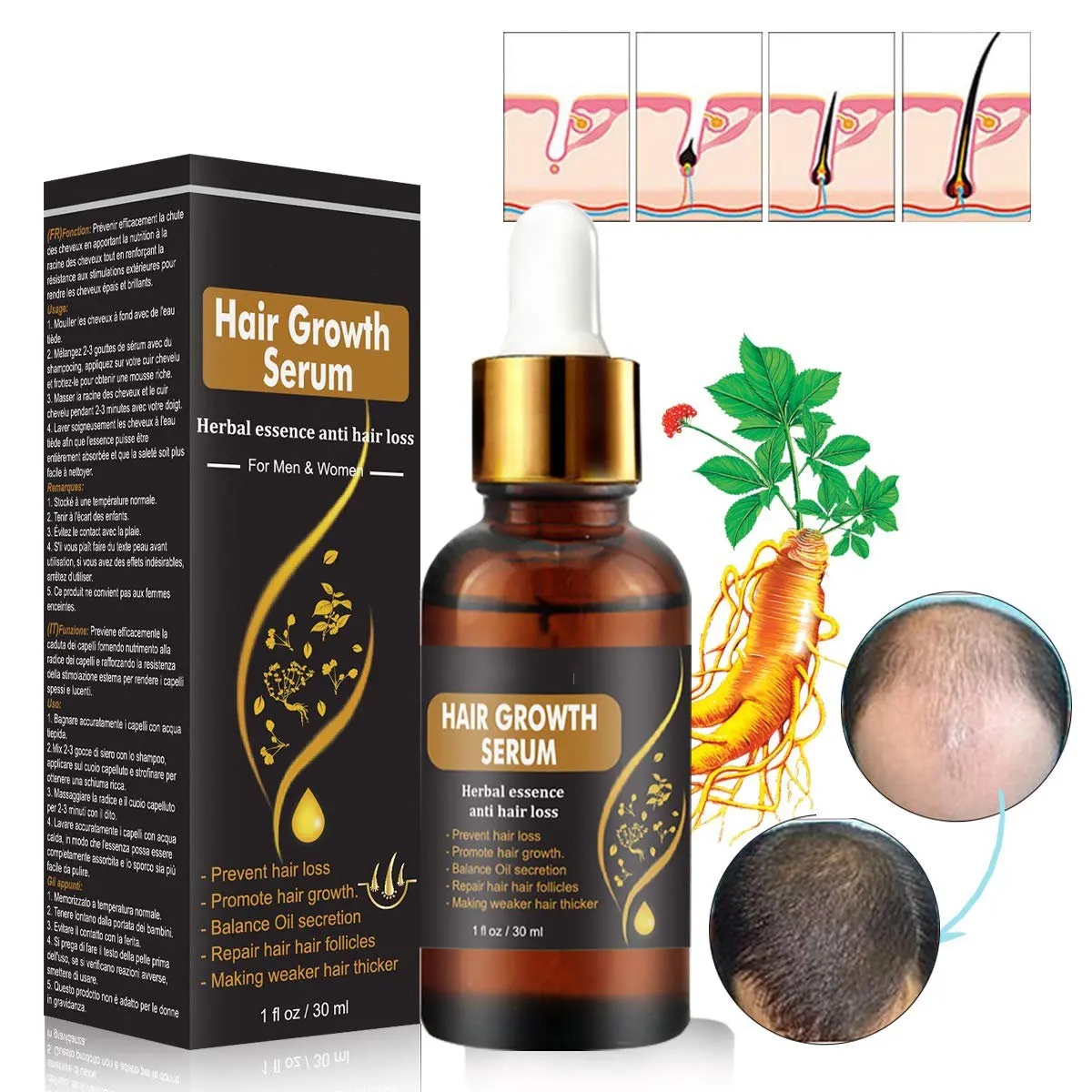 Private Label Hair Growth Serum Stops Hair Loss Promotes Thicker Faster ...