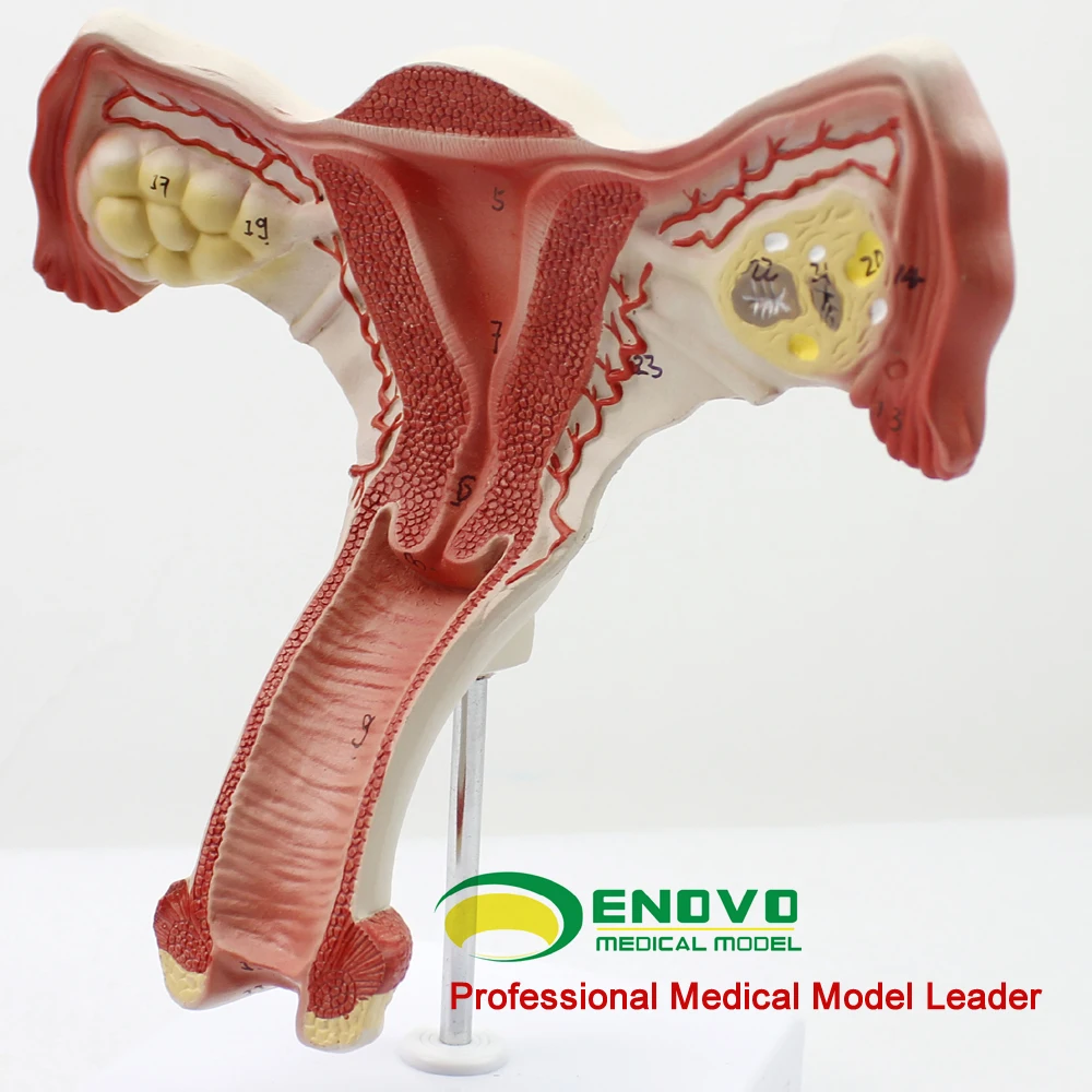 Enovo/子宮 & 卵巣、泌尿生殖器医療教育解剖モデル、 12443 Buy 女性内部性器モデル、断面人体モデル、ホット科学モデル