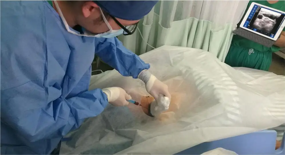 Doppler ultrasound Transducer USG small ultrasonic transducer wireless ultrasound Probe Machine