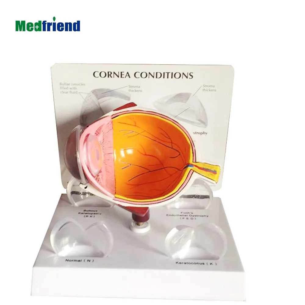 Factory Price Advanced Anatomical Eye Model Buy Advanced Anatomical