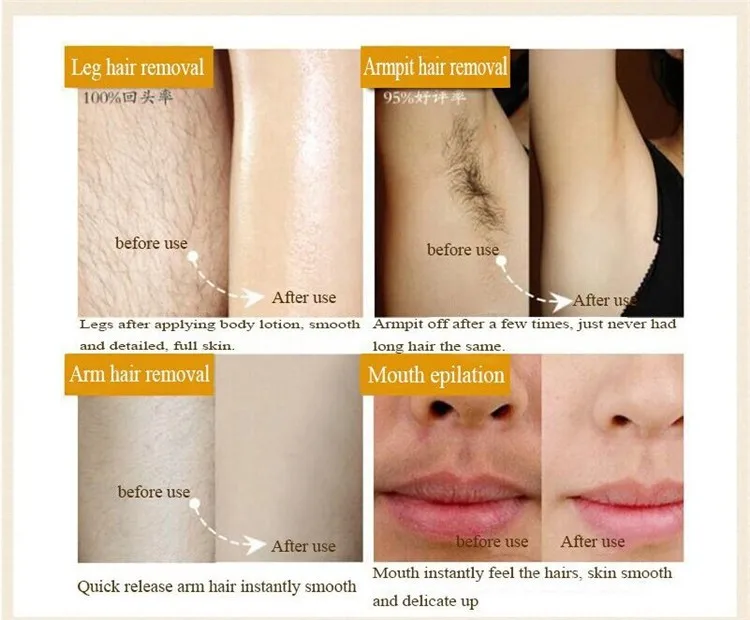 permanent facial hair removal products