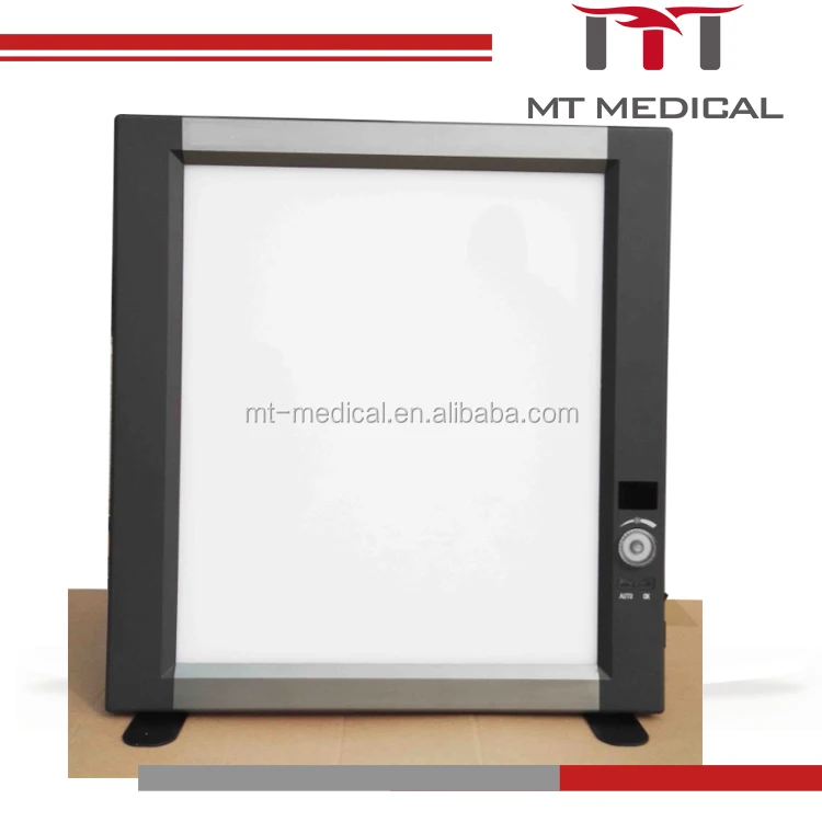 Medical LED X-ray Negatoscope X-ray Film Viewer Price for Sale