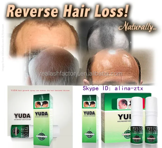 Best Hair Regrowth Product On The Market Best Hair Regrowth Produce On The Market