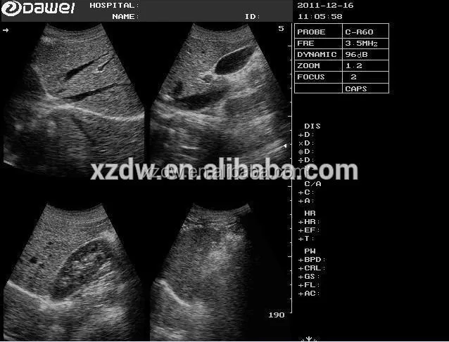 abdomen.jpg