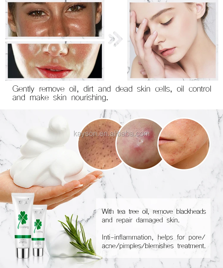 medicated cream for pigmentation