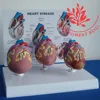 Desk education model set of three heart disease model
