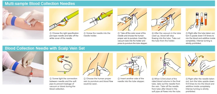 Алгоритм забора. Забор крови вакуумной системой алгоритм. Забор крови вакутейнером из вены алгоритм. Техника взятия крови из вены вакуумными пробирками алгоритм. Взятие крови вакуумной системой схема.