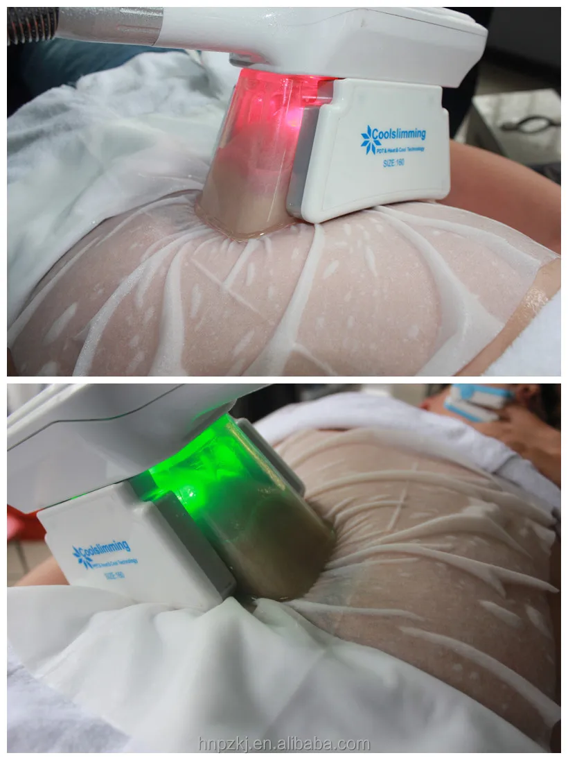 2016 New Launched Zero Cryo Lipo Machine Portable Cold Laser