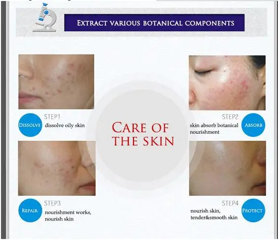 Bioaqua face cream anti acne treatment cream oil control Moisturizing Acne Scar Remover Pores acne cream
