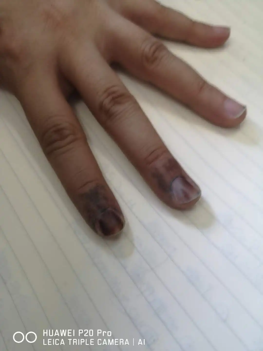 Election Ink Indelible Ink