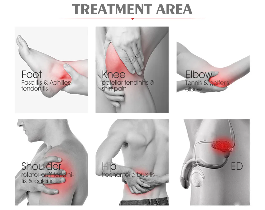 treatment areas.jpg