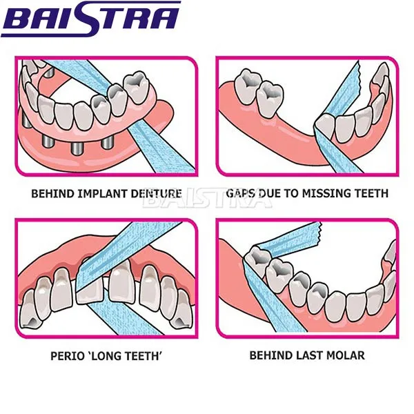 Effective Dental Wide Gauze Floss For Wide Space Between Teeth Buy