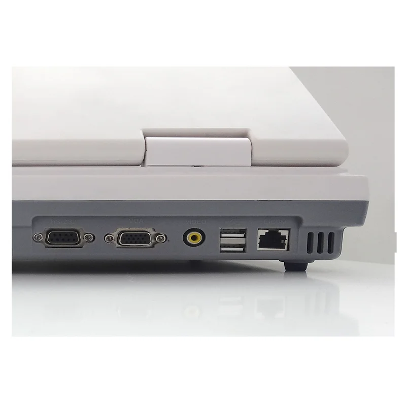 B/W Portable Ultrasound System Scanner YJ-U580