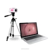 SW-3301 Portable Digital Video Colposcope / Portable Colposcope Introduction /Vaginal Colposcope
