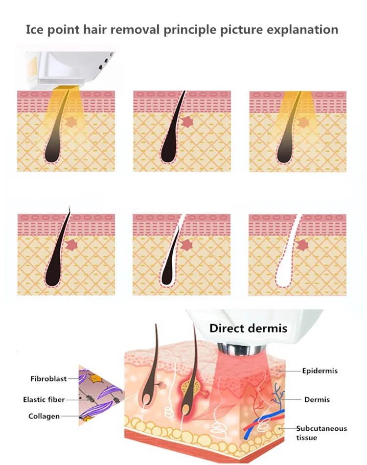 Можно ли удалять волосы пинцетом. Лампа для выщипывания бровей. Выщипывание волос на лице пинцетом. Можно ли удалять волосы пинцетом. Можно ли удалять волосы пинцетом.