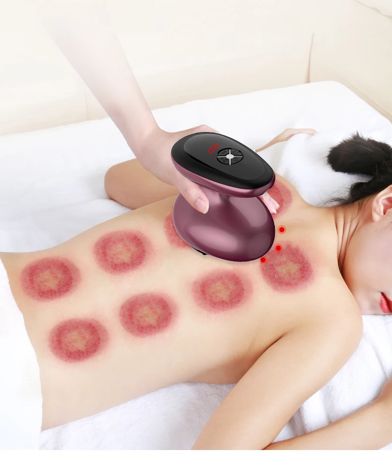 Wholesale Top Quality Scraping massager Electric Scraping Massage for body scraping instrument