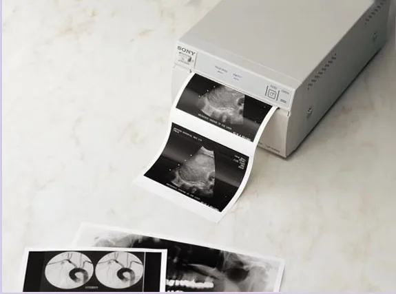 UPP-110S CBCGT Type I Black And White Video Thermal New for Sony Ultrasound Pinter 110mm x 20m 10 ROLLS UPP-110S CBCGT Type I Black And White Video Thermal New for Sony Ultrasound Pinter 110mm x 20m 10 ROLLS