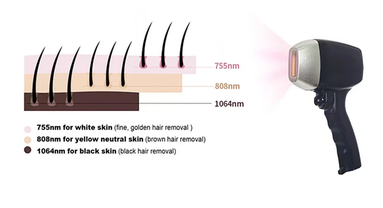 2020 Newest Diode Laser 808 nm Alma Soprano ICE Platinum Diode Laser Hair Removal Machine Price