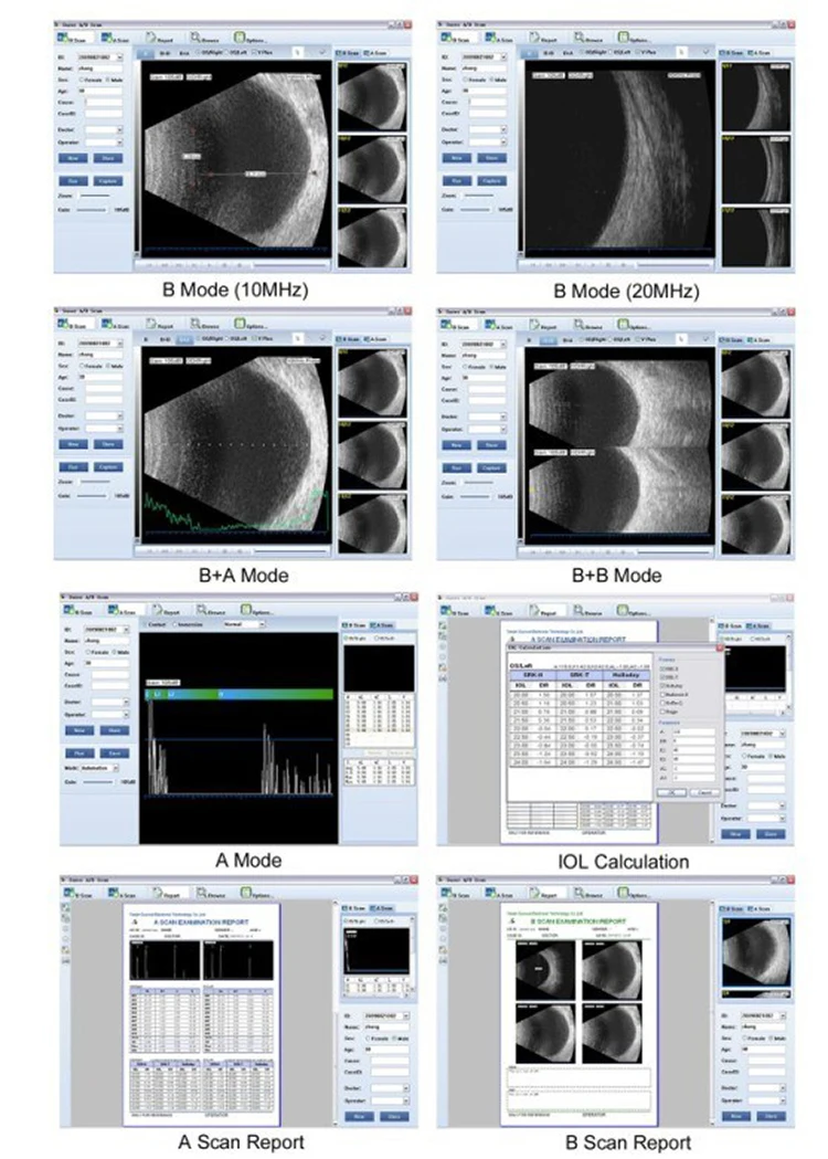 Скан 10. SW-2100 ультразвуковые сканеры. PTC 2100 Ultrasound.