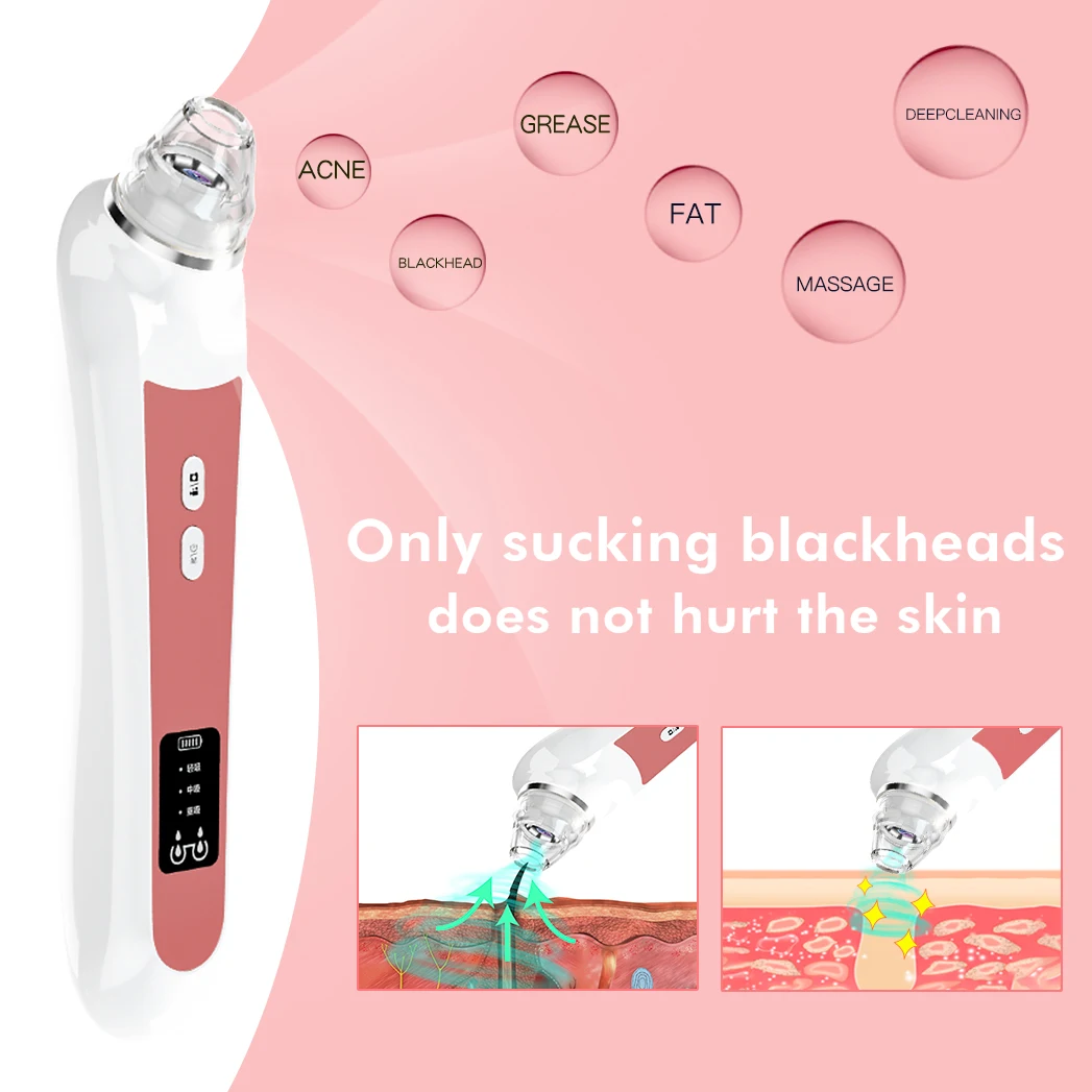 vacuum blackhead remover