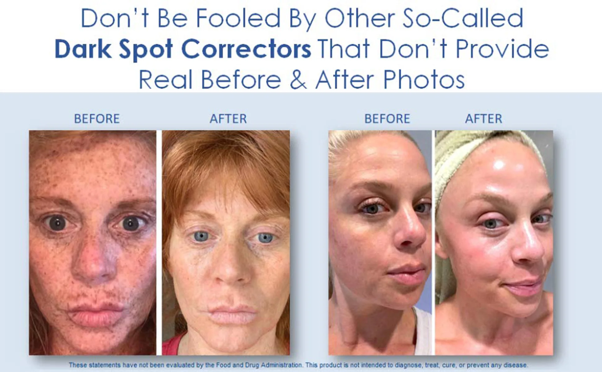 whitening freckle corrector