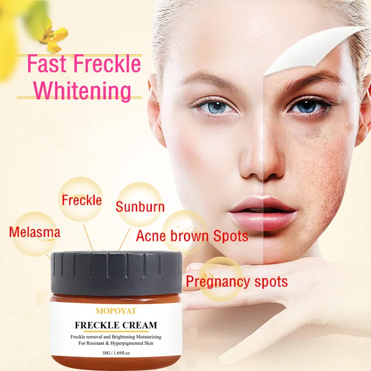 Private Label Wholesale Facial Skin Care Beauty Whitening Anti Best Freckle Removing Cream